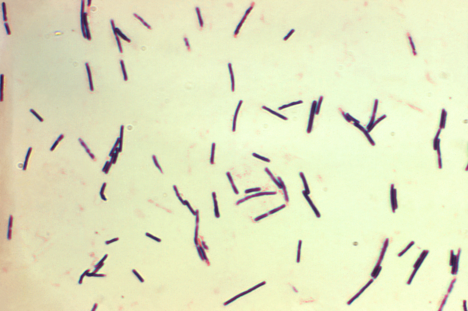 Relação entre o Clostridium perfringens e o sistema imune de frangos de corte